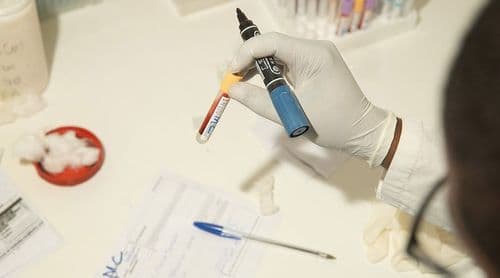 Saúde: Sindicatos dizem que posicionamento do Governo está a “enfurecer” trabalhadores e a condicionar entendimento