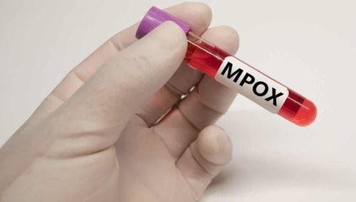 Mais de 18.700 casos suspeitos ou confirmados de Mpox em África desde início do ano